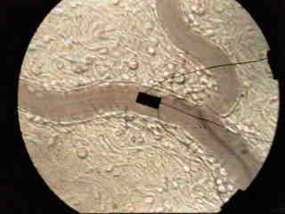 flowmeter